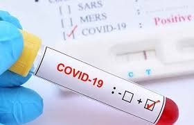 চট্টগ্রামে ২জন করোনায় আক্রান্ত